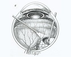 ���������� ��������������� �������� ������� ������������� ������� 