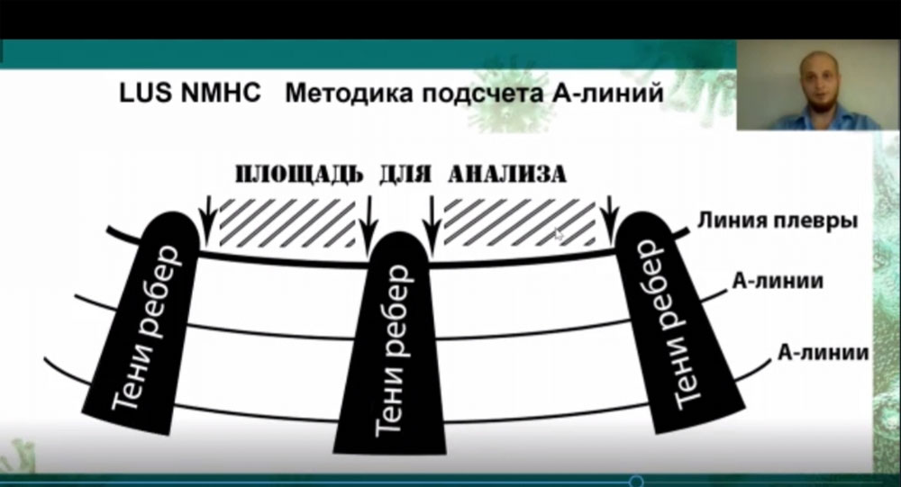 Доклад: Коронавирусная инфекция