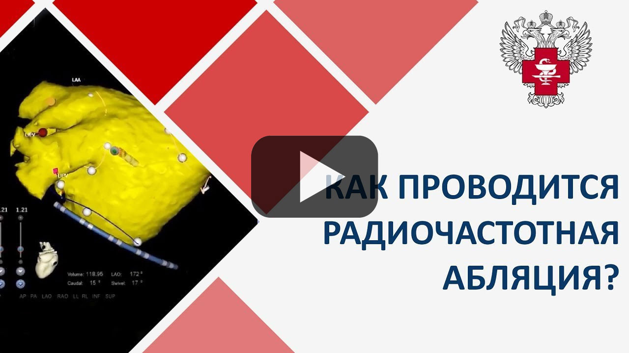 Посмотреть на YouTube