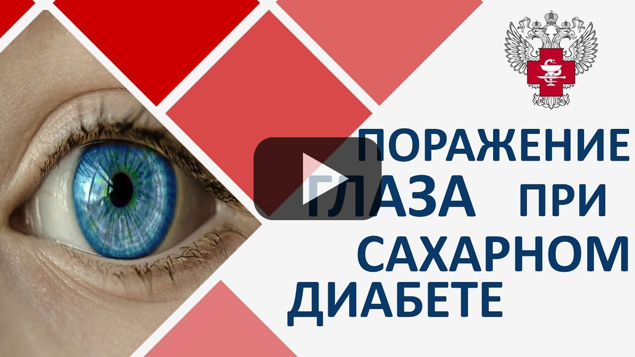 Посмотреть на YouTube