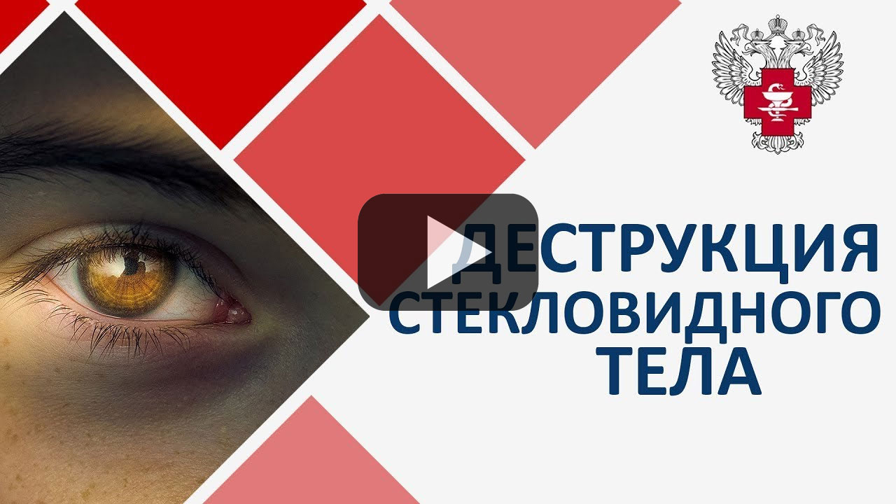 Посмотреть на YouTube