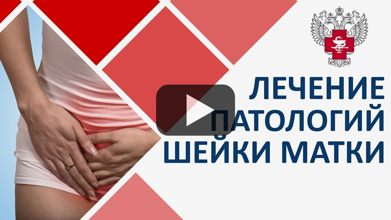 Посмотреть на YouTube