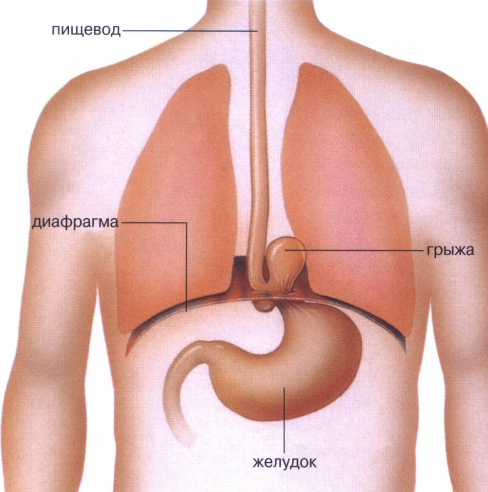 Рис. 1. Схема расположения ГПОД