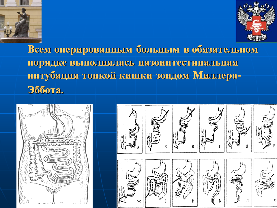 Зонд в кишечник. Назоинтестинальный зонд Миллера-Эббота. Назоинтестинальная интубация зондом Миллера Эббота. Интубвция тонкого кишечниканазоинтестинальная. Назоинтестинальный зонд тонкой кишки.