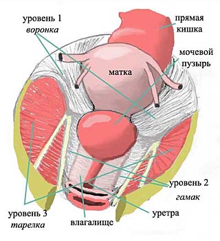 Как Выглядит Опущение Матки Фото