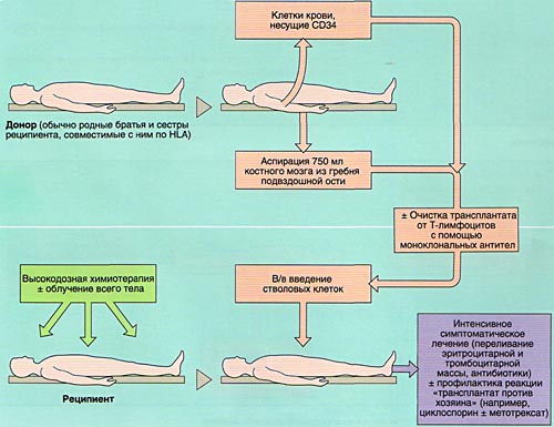 Аллогенная трансплантация костного мозга