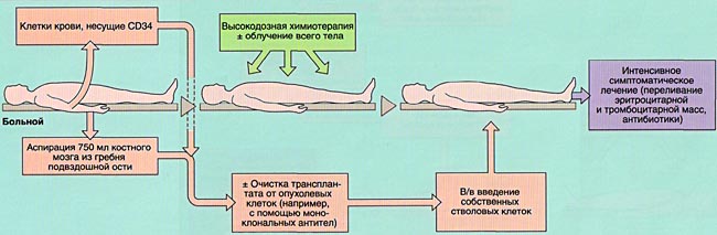 Аутологичная трансплантация костного мозга