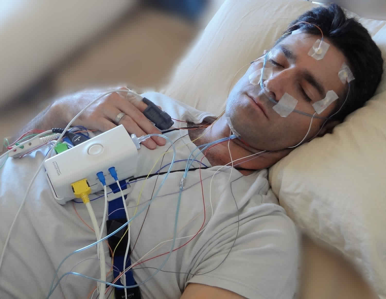 Appearance of the patient during the polysomnography study