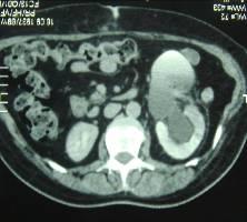 Мультиспиральная компьютерная томография органов брюшной полости, забрюшинного пространства
