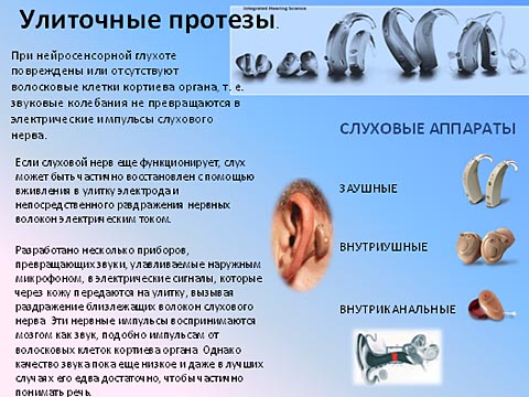 Улиточные протезы