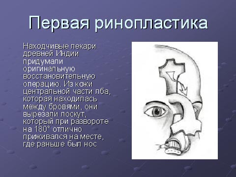 Первая ринопластика
