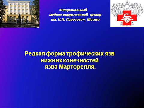 Редкая форма трофических язв нижних конечностей, язва Марторелля