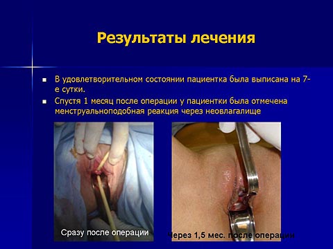 Результаты лечения