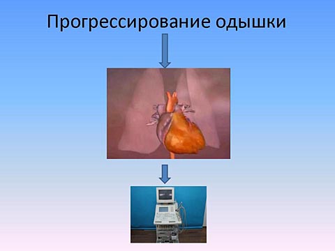 Прогрессирование одышки