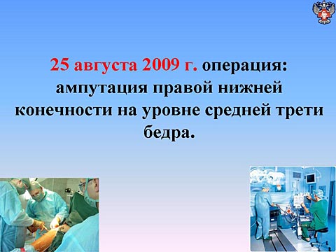 Операция: ампутация правой нижней конечности