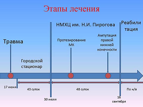 Этапы лечения пациента с сочетанной механической травмой: митральным пороком и множественными переломами