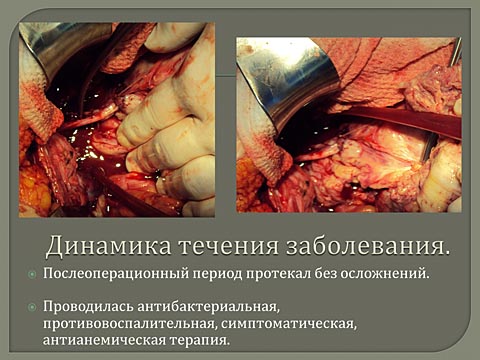 Лечебная тактика при нерезектабельной саркоме тела матки