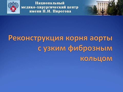 Реконструкция корня аорты с узким фиброзным кольцом