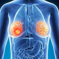 Department of Surgical Treatment of Cancer Patients (Surgery No. 1)