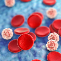 Department of Hematology and Chemotherapy with a room of bone marrow and hematopoietic stem cells transplantation